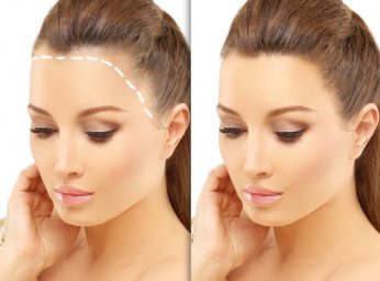 Hair Transplant Guide for Understanding Hair Restoration Hair Transplant Guide for Understanding Hair Restoration