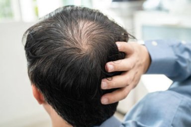 Understanding the Science Behind PRP Hair Treatment for Hair Growth Understanding the Science Behind PRP Hair Treatment for Hair Growth