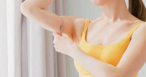 Arm Lift Surgery and Its Impact on Your Body Confidence Arm Lift Surgery and Its Impact on Your Body Confidence