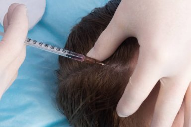 PRP Hair Treatment: Understanding Its Role in Modern Hair Regrowth PRP Hair Treatment: Understanding Its Role in Modern Hair Regrowth